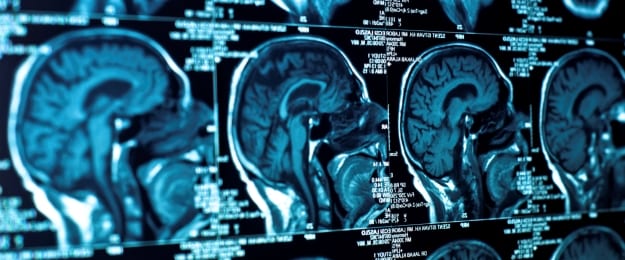 Abilene Brain Injury Lawyer brain injury lawyer frank giunta